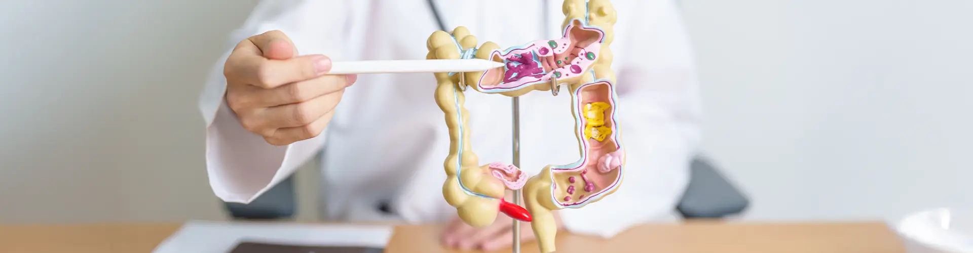 Colon Cancer: Stages, Types, Symptoms, Diagnosis & Treatment