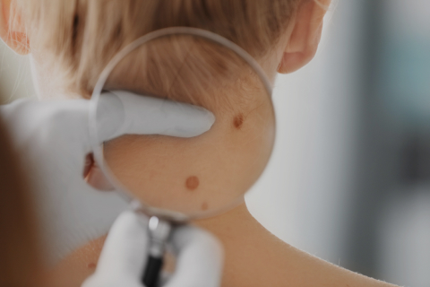 Large Ductal Carcinoma