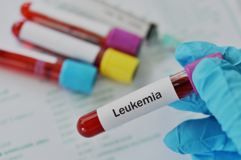 Acute leukemia