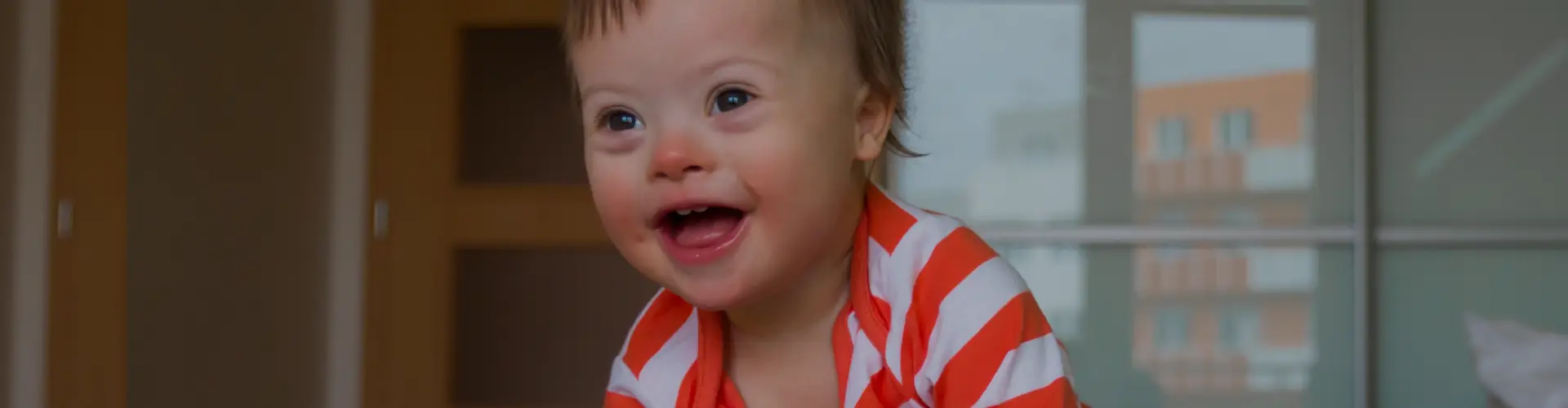 Down Syndrome: Types, Symptoms, Causes & Treatment