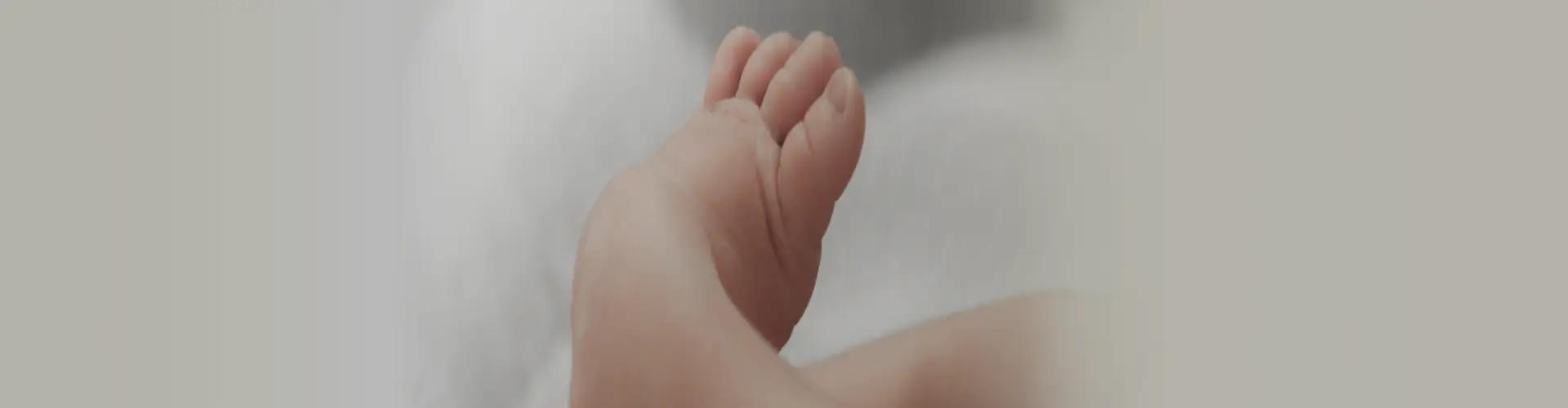 Clubfoot: Types, Symptoms, Causes, Diagnosis & Treatment