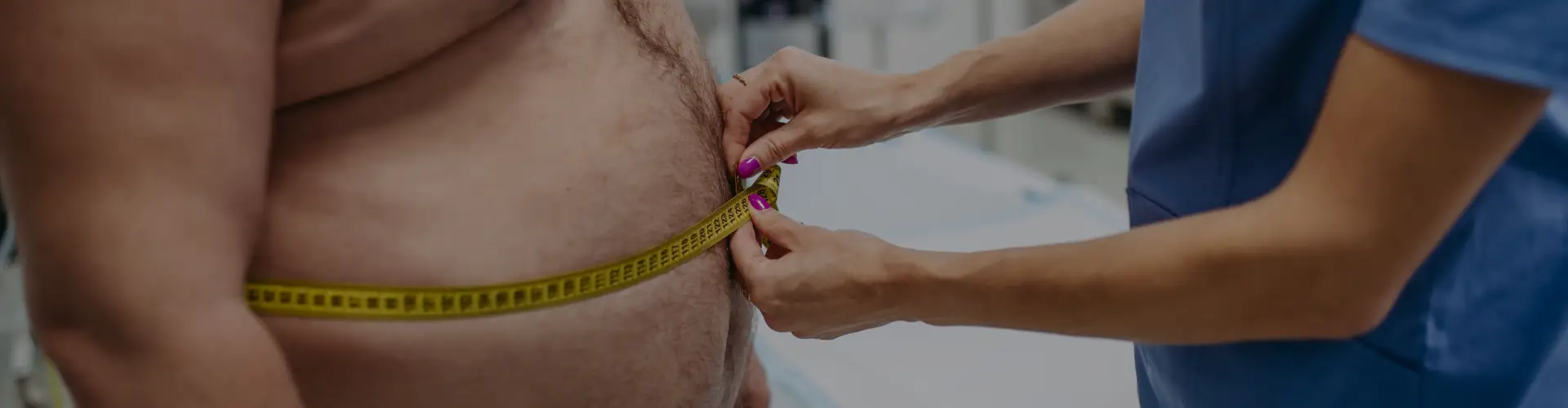 Obesity: Types, Symptoms, Causes, Treatment & Myths