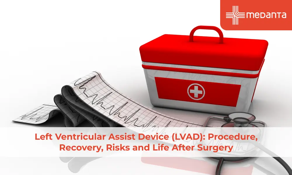 Left Ventricular Assist Device (LVAD): Procedure, Recovery, Risks and Life After Surgery