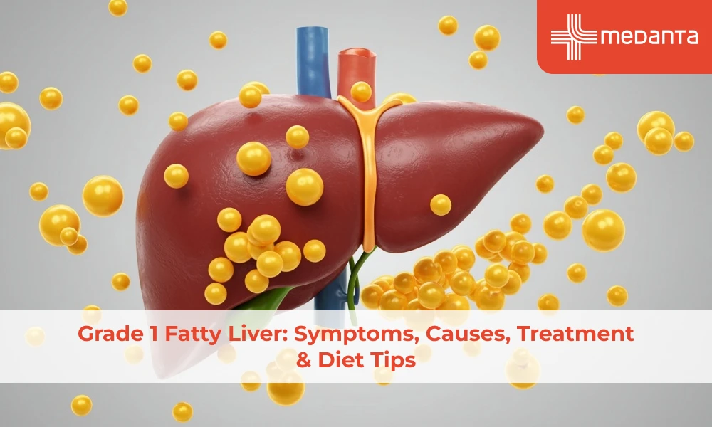 grade-1-fatty-liver-symptoms-causes-treatment-diet-tips