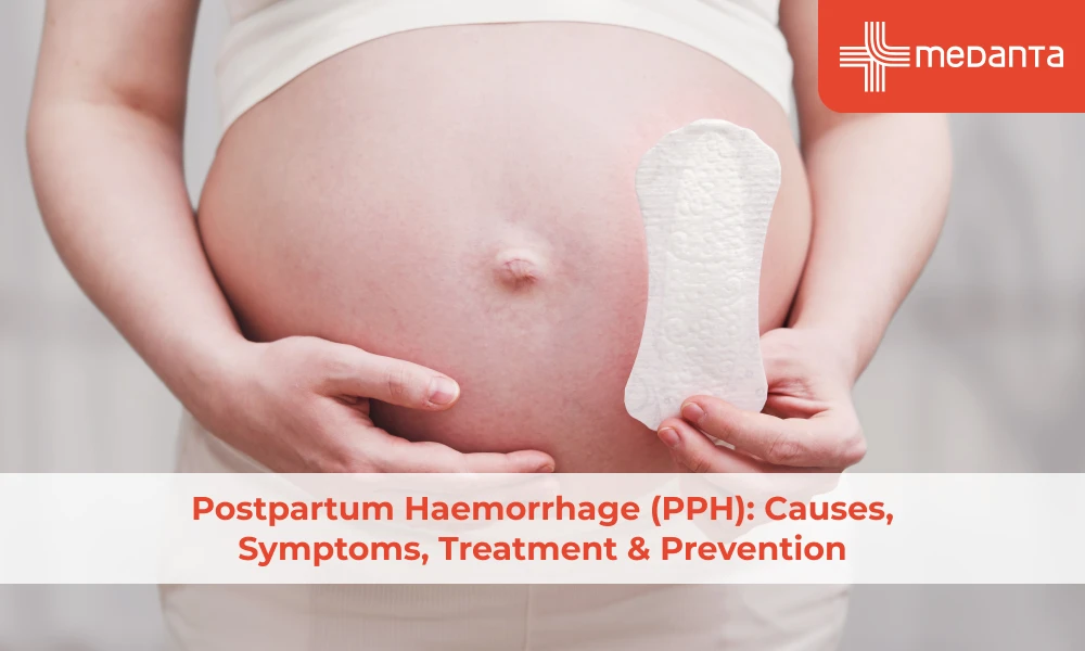 Postpartum Haemorrhage (PPH): Causes, Symptoms, Treatment & Prevention