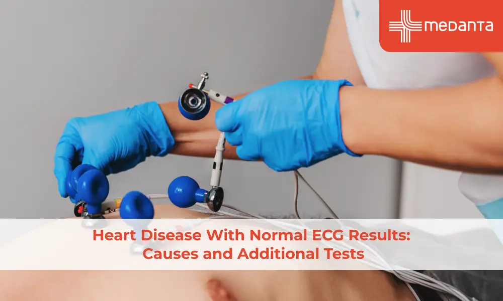 heart-disease-with-normal-ecg-results-causes-and-additional-tests