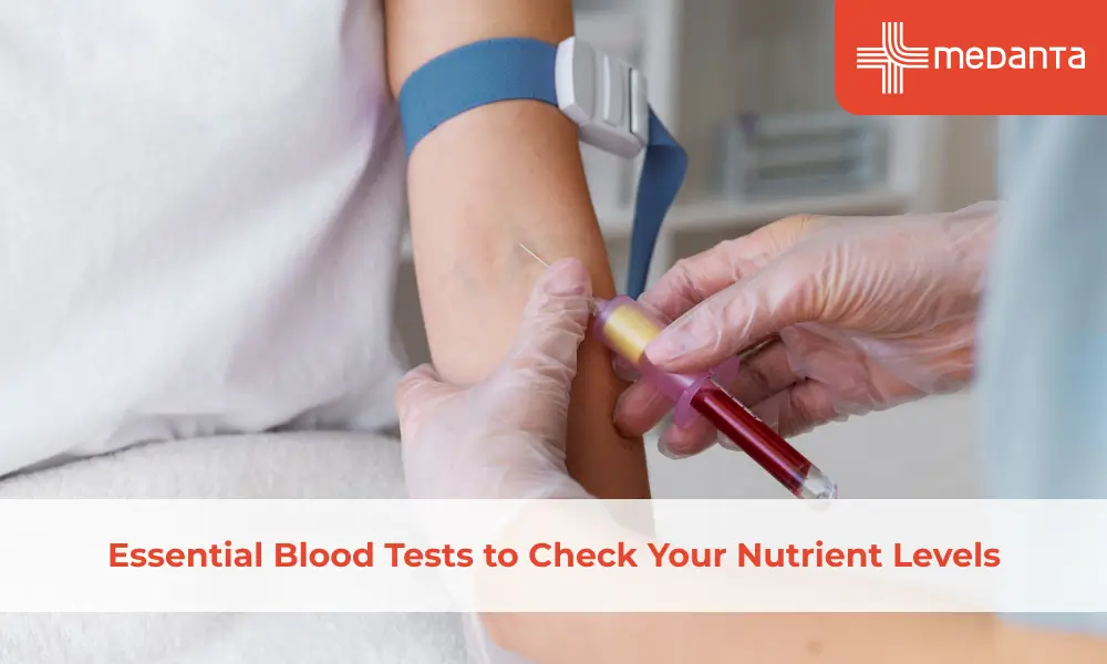 essential-blood-tests-to-boost-health