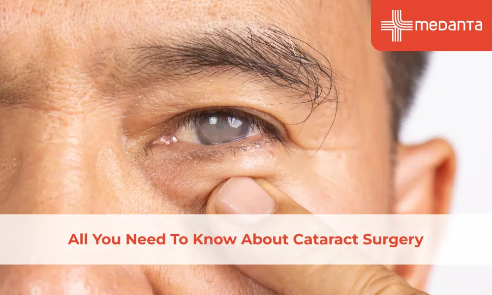 All You Need To Know About Cataract Surgery