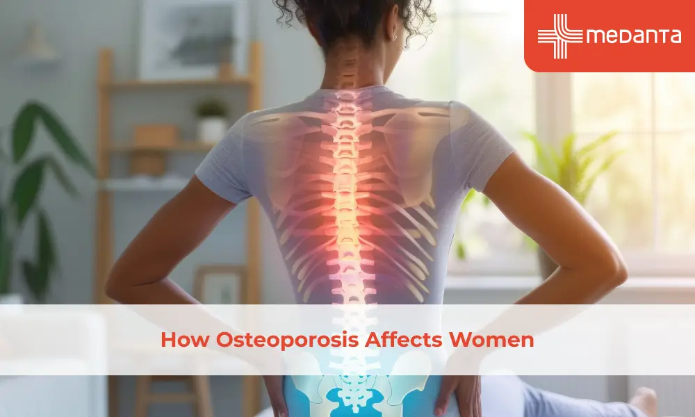 How Osteoporosis Affects Women