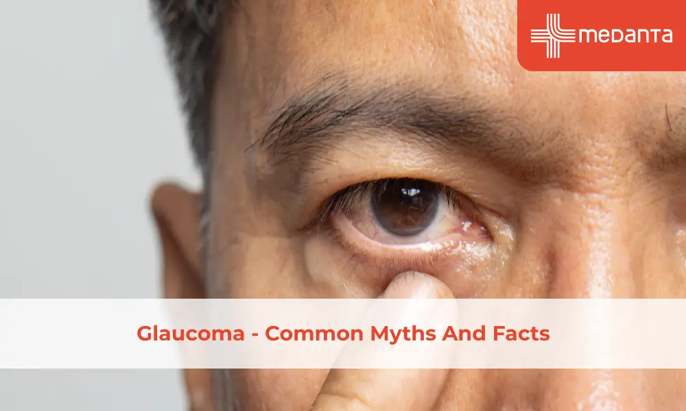 Glaucoma - Common Myths And Facts