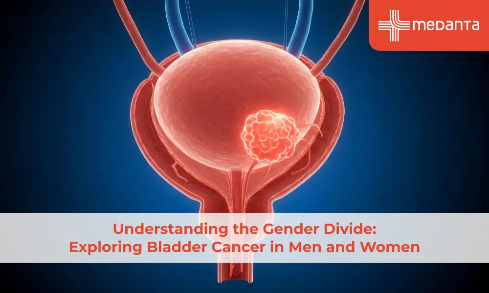 Understanding the Gender Divide in Bladder Cancer: Men vs. Women