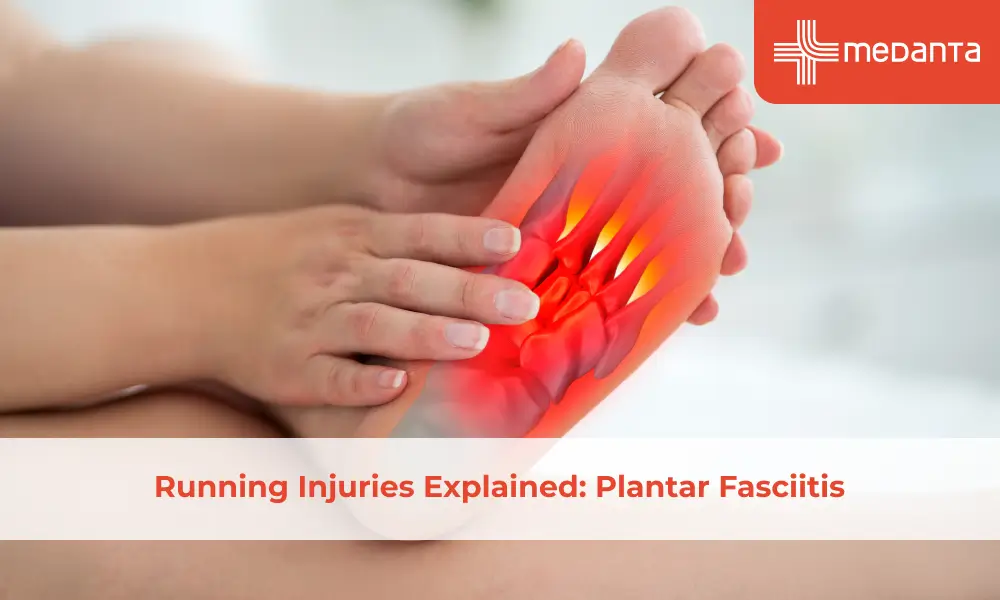 Running Injuries Explained: Plantar Fasciitis