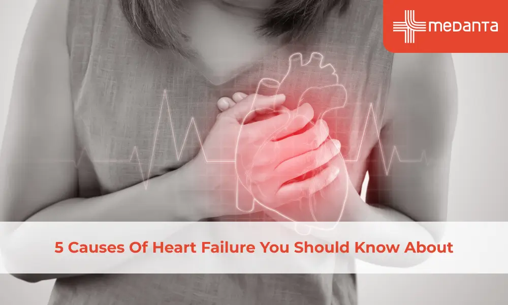 5-causes-of-heart-failure-you-should-know-about