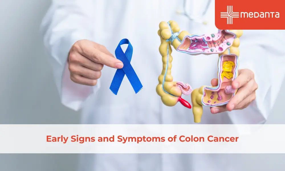 Early Signs and Symptoms of Colon Cancer