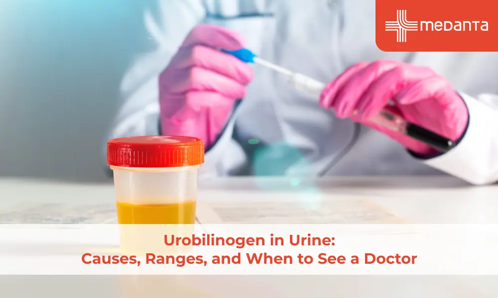 urobilinogen-in-urine-when-to-see-doctor