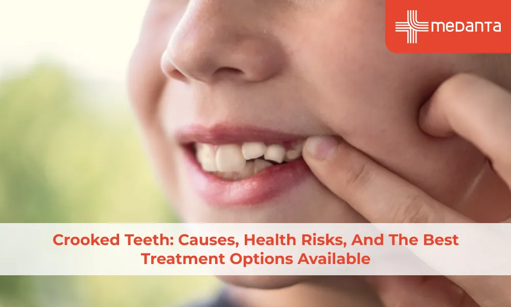 Crooked Teeth: Causes, Health Risks, and the Best Treatment Options Available