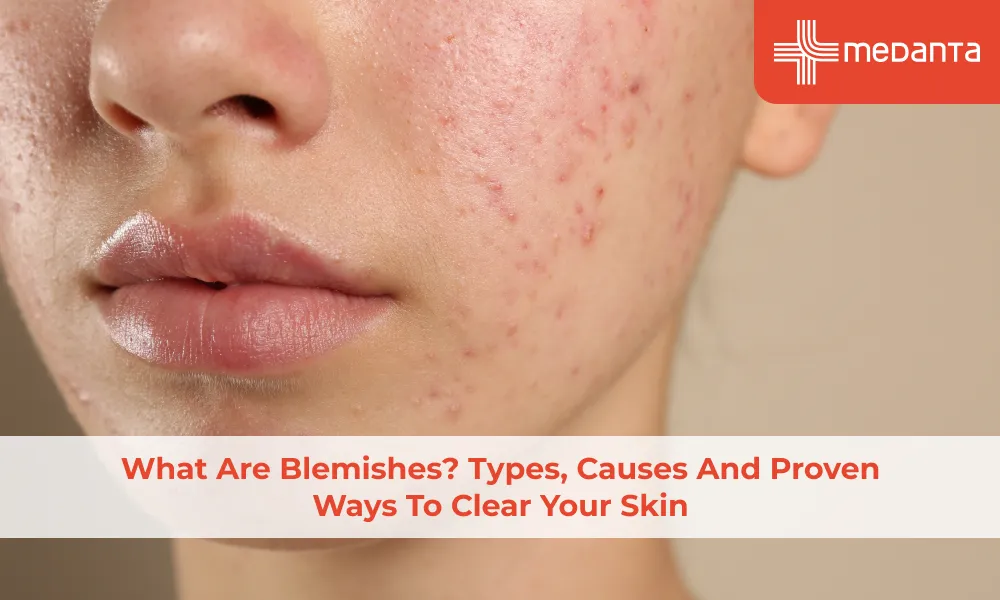what-are-blemishes-types-causes-and-proven-ways-to-clear-your-skin