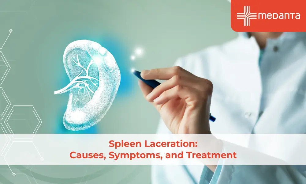 Spleen Laceration: Causes, Symptoms, and Treatment