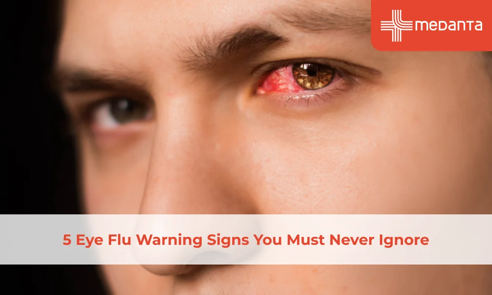 Eye Flu Warning Signs