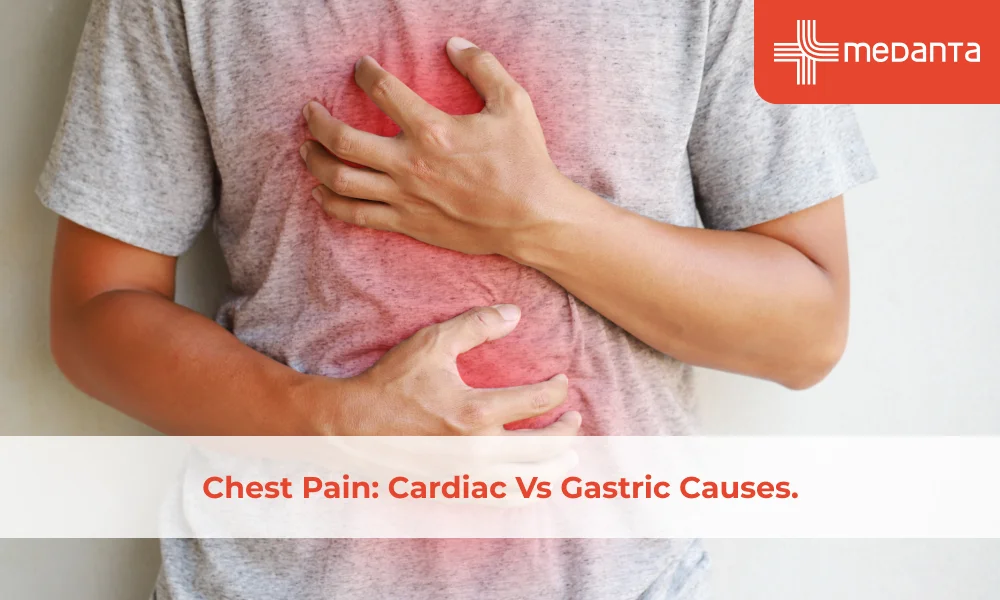 Chest Pain: Cardiac Vs Gastric Causes.