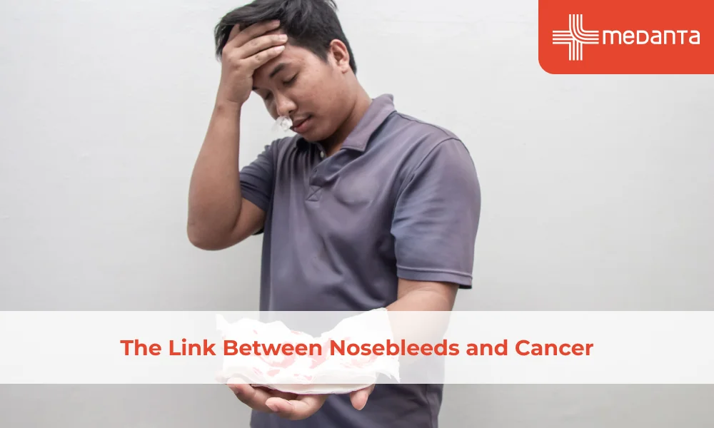 The Link Between Nosebleeds and Cancer