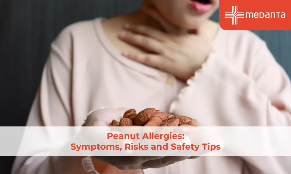 Peanut Allergies: Symptoms, Risks and Safety Tips
