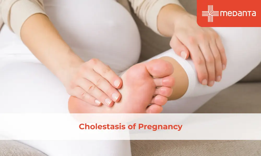 Cholestasis of Pregnancy