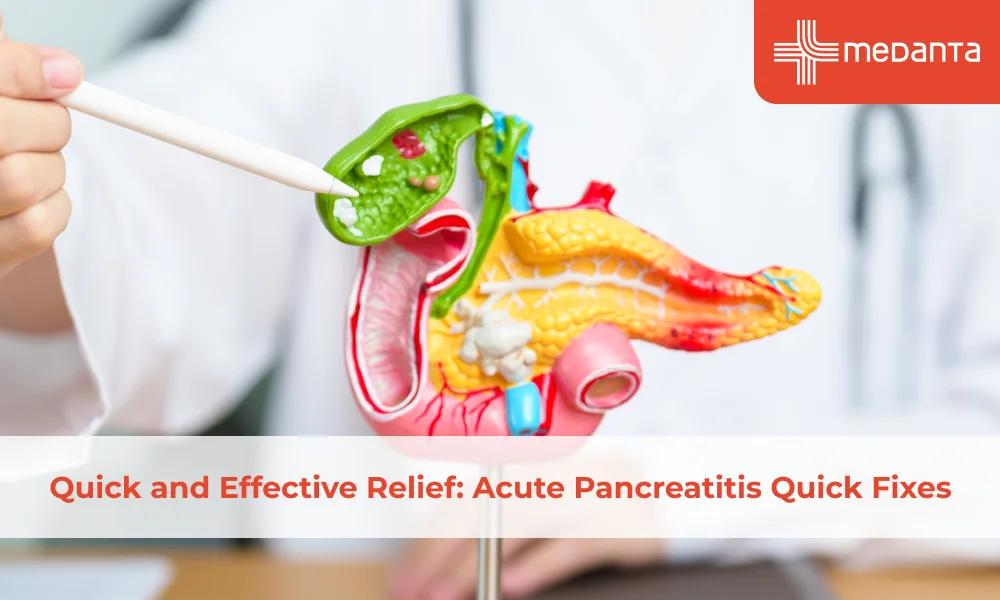 Acute Pancreatitis