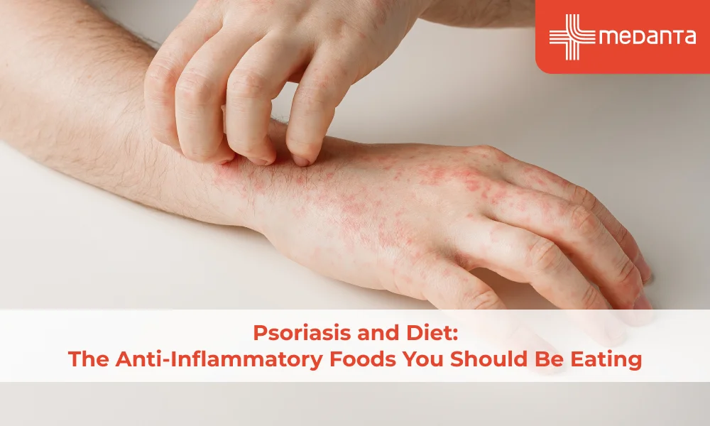  Anti-Inflammatory Foods 