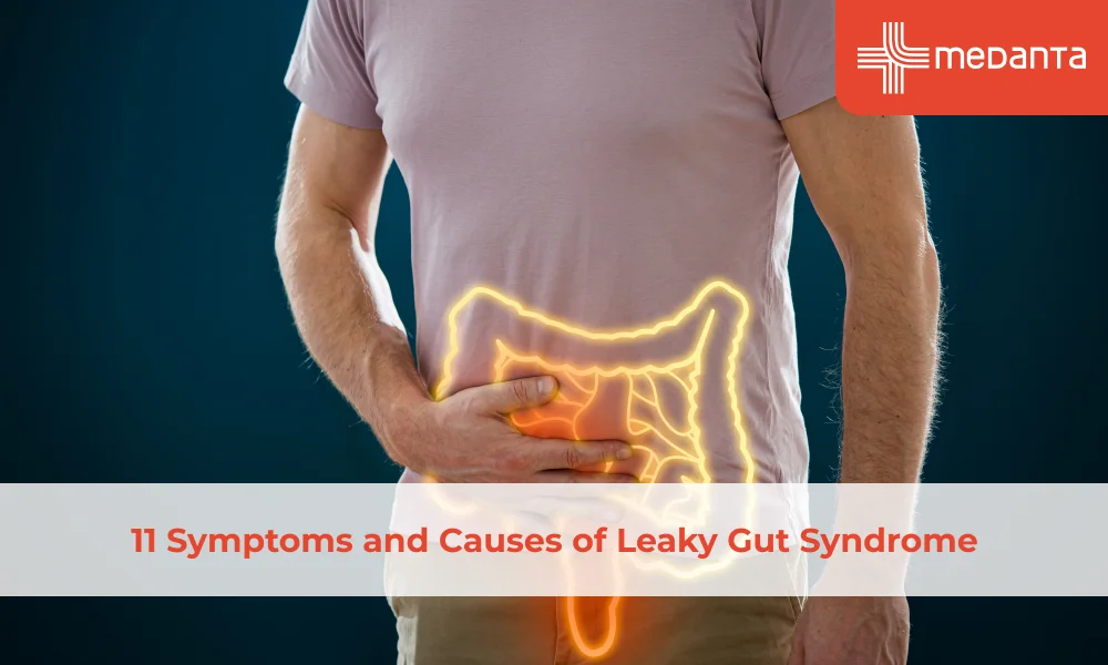 Leaky Gut Syndrome