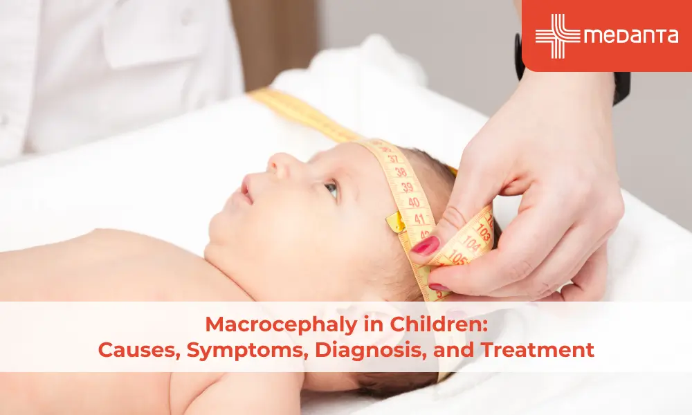 Macrocephaly in Children: Causes, Symptoms, Diagnosis, and Treatment