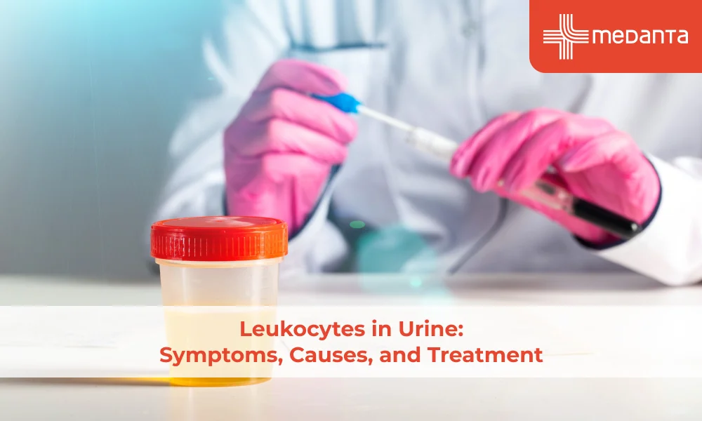Leukocytes in Urine: Symptoms, Causes, and Treatment