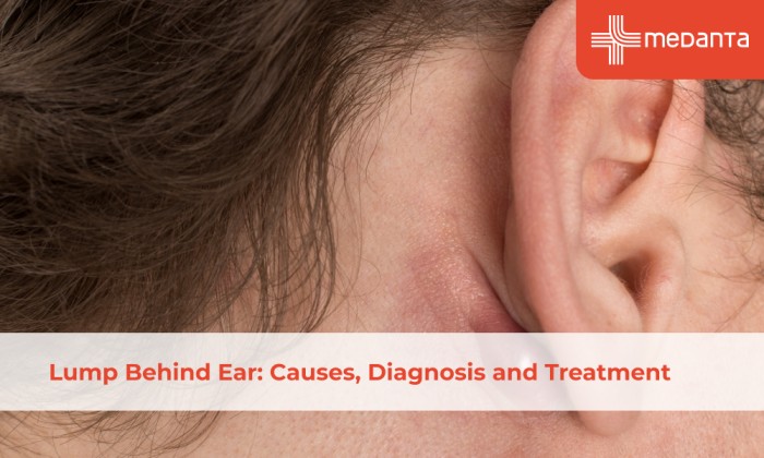 lump-behind-ear-causes-diagnosis-and-treatment