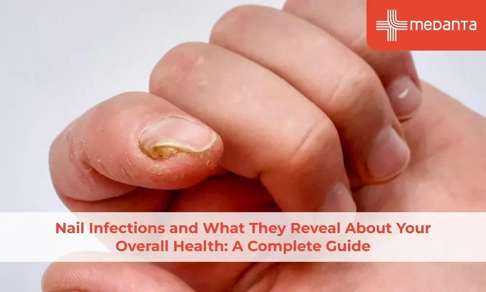 nail-infections-and-what-they-reveal-about-your-overall-health-a-complete-guide