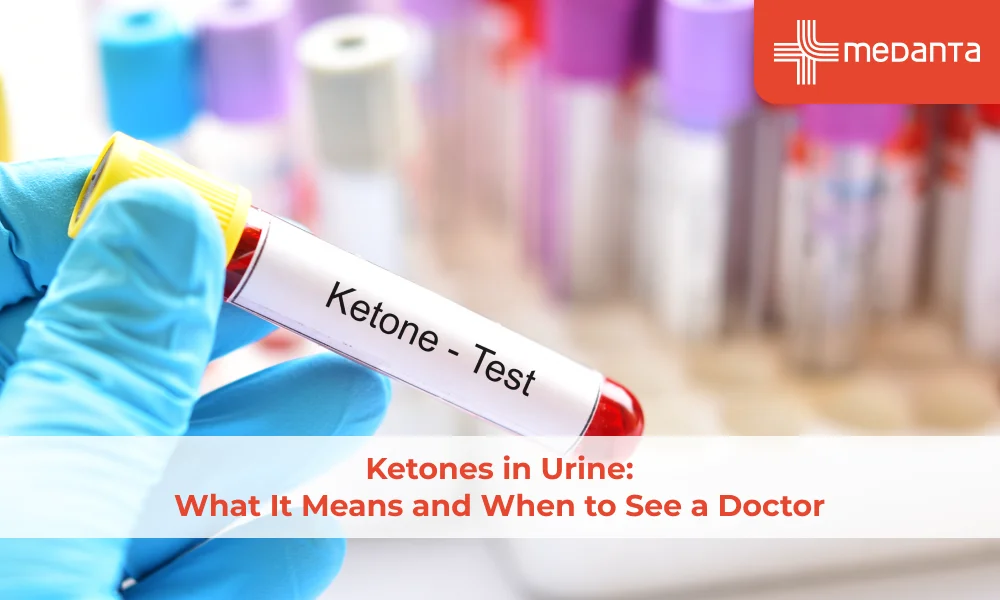 Ketones in Urine: What It Means and When to See a Doctor