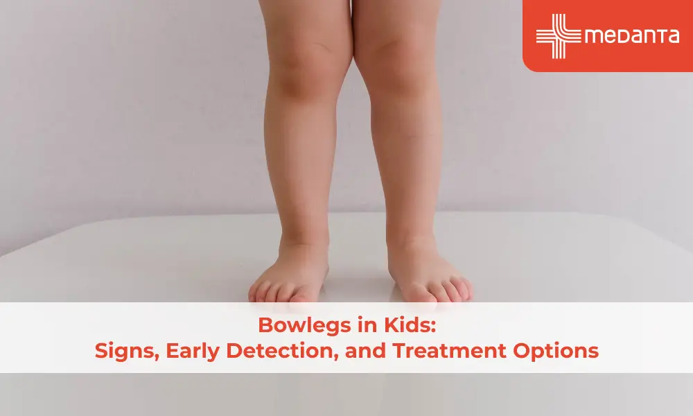Bowlegs in Kids: Signs, Early Detection, and Treatment Options