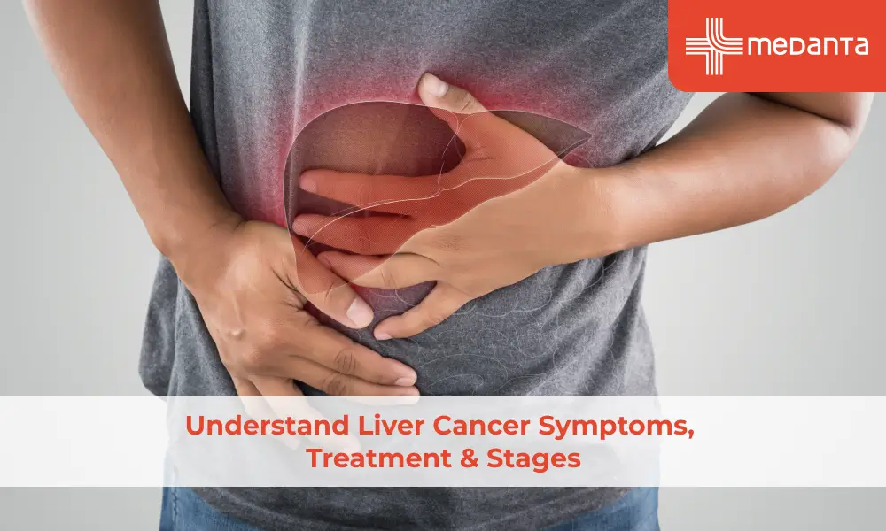 Understand Liver Cancer Symptoms, Treatment & Stages