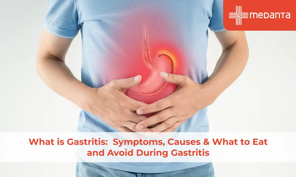 What is Gastritis? Symptoms, Causes & What to Eat and Avoid During Gastritis