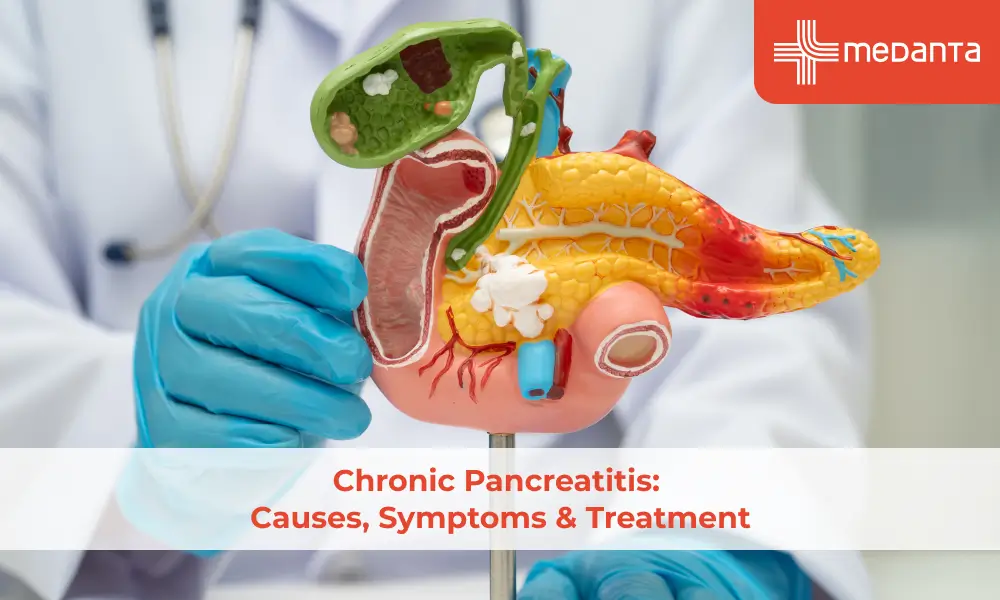 Chronic Pancreatitis Causes, Symptoms & Treatment