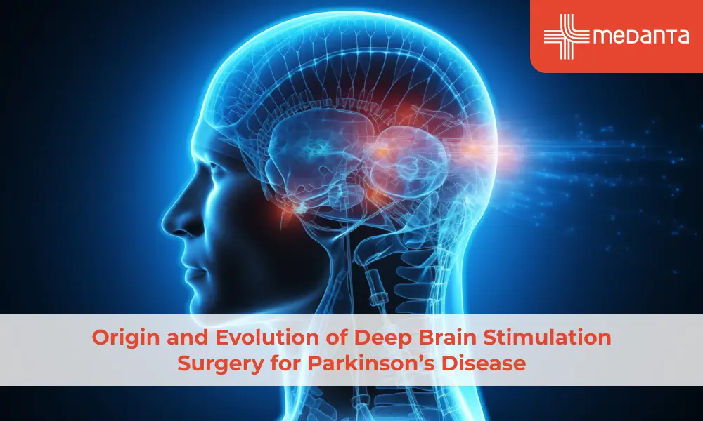Origin and Evolution of Deep Brain Stimulation Surgery for Parkinson’s Disease