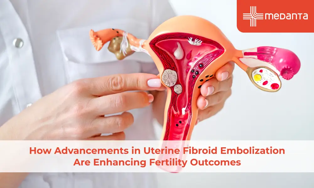 How Advancements in Uterine Fibroid Embolization Are Enhancing Fertility Outcomes