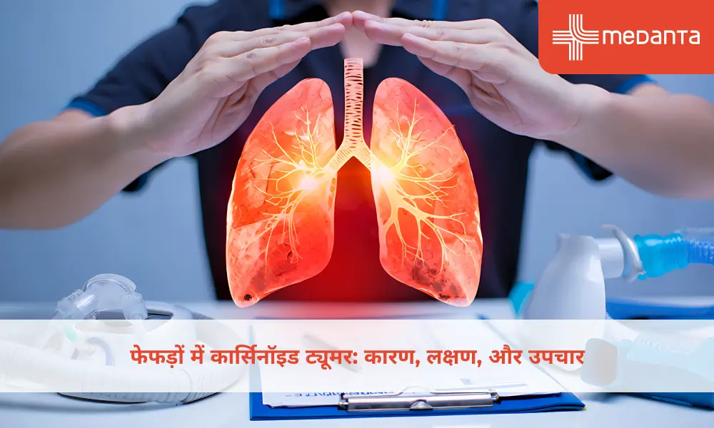 फेफड़ों में कार्सिनॉइड ट्यूमर: कारण, लक्षण, और उपचार 