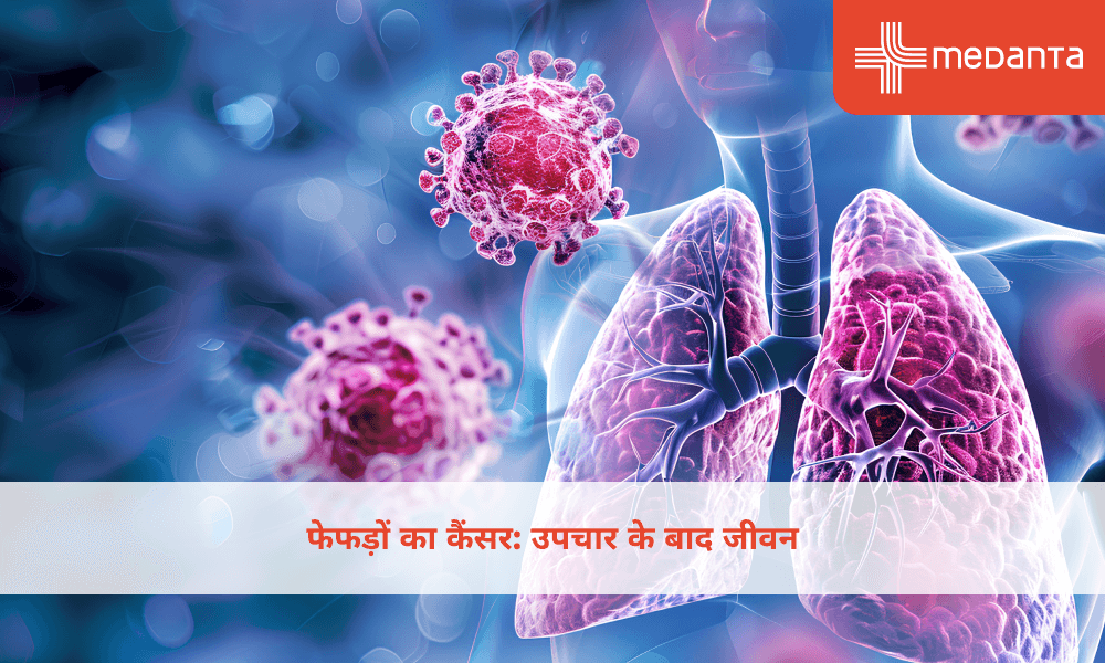 फेफड़ों का कैंसर: उपचार के बाद जीवन