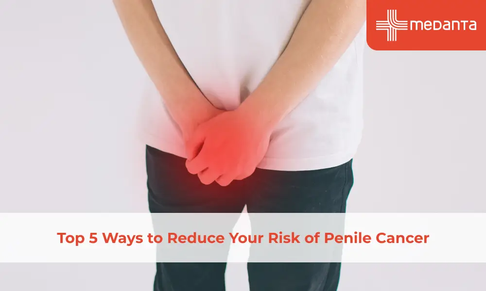 Top 5 Ways to Reduce Your Risk of Penile Cancer