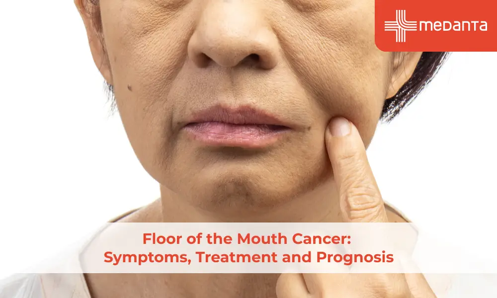 Floor of the Mouth Cancer