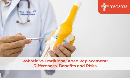 Robotic vs Traditional Knee Replacement: Differences, Benefits and Risks