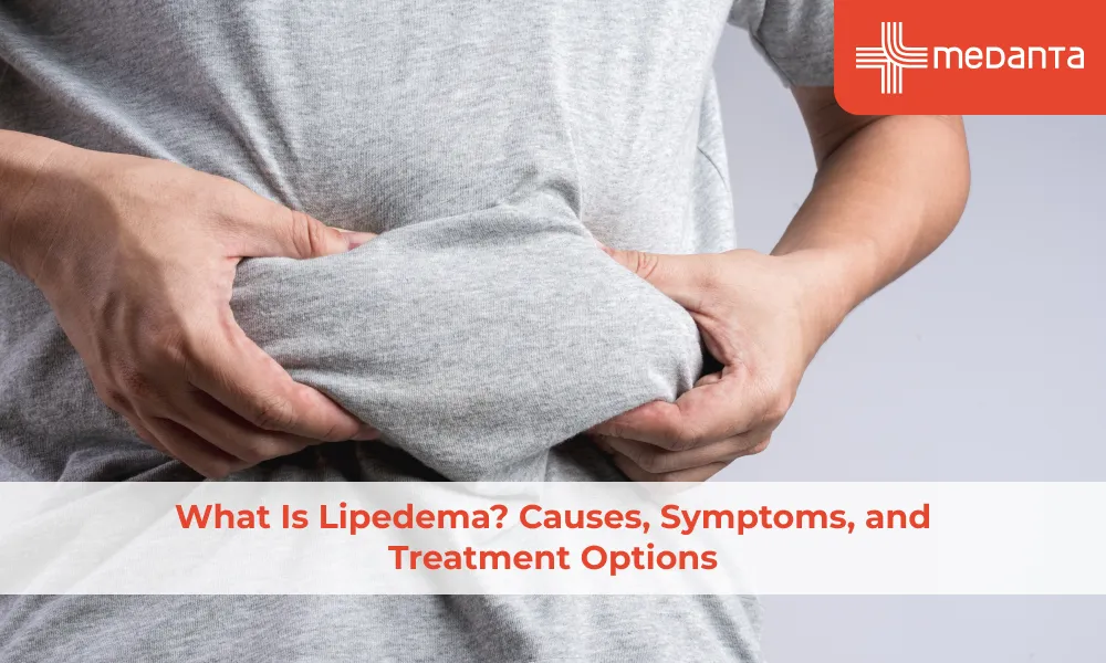 What Is Lipedema? Causes, Symptoms, and Treatment Options