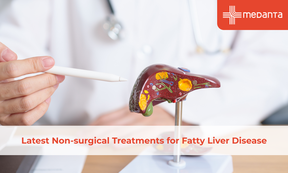 Latest Non-surgical Treatments for Fatty Liver Disease