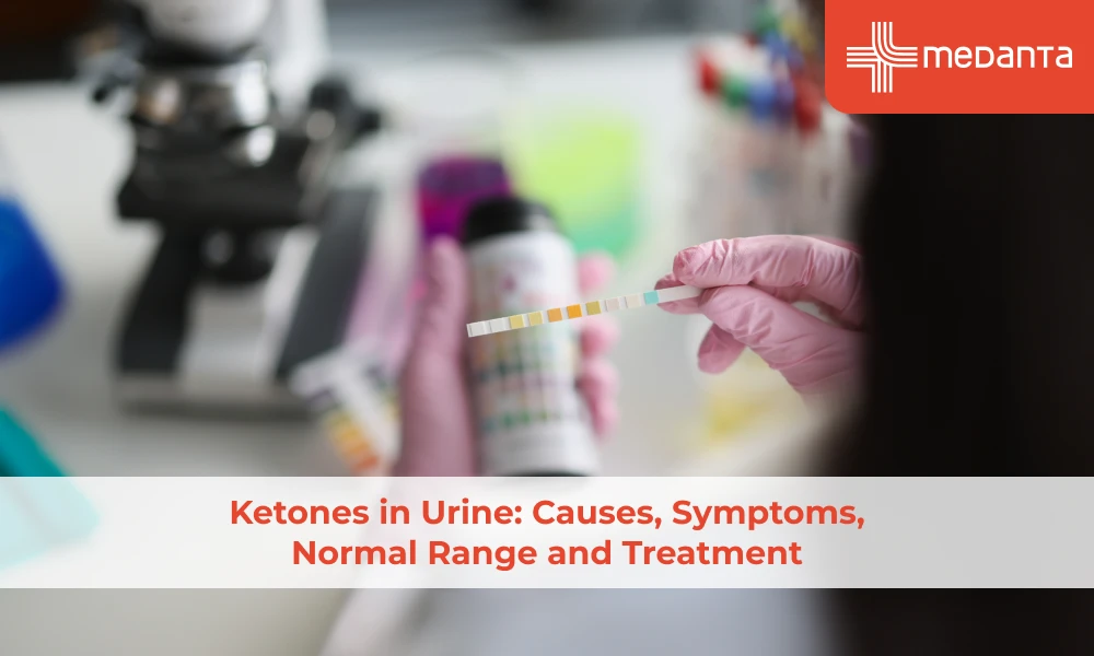 ketones-in-urine-causes-symptoms-normal-range-and-treatment