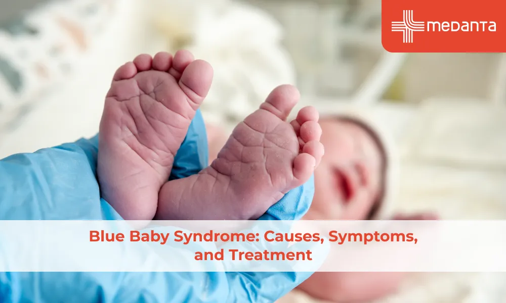 blue-baby-syndrome-causes-symptoms-and-treatment